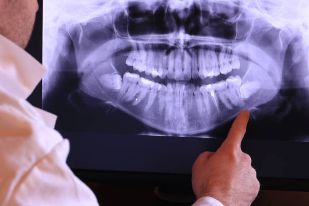Best Urgent Tooth Repair  in Wild Peach Village, TX